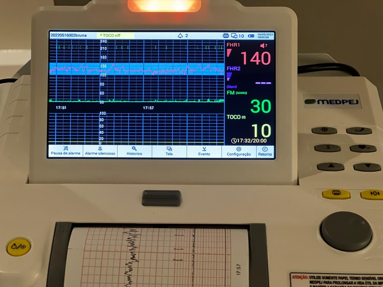 EXAME DE CARDIOTOCOGRAFIA